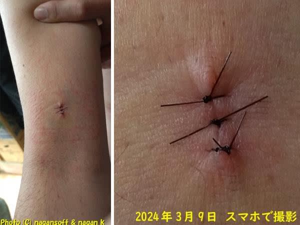 https://nagan.blog/hopewreck/item-space/2024/03/e0ccefeffc161fec24f29ea2bf652fcb.jpg