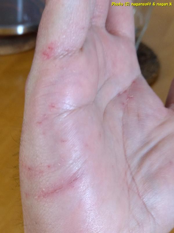 釣ったアジが暴れるので右手がキズだらけになる、それを「アジの祟り」という。|泉佐野市「なが~ン」氏自宅。2024年04月12日撮影